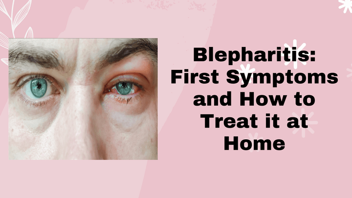 Understanding Blepharitis Causes and Treatment with Base Labs Hypochlorous Acid Eyelid Cleanser