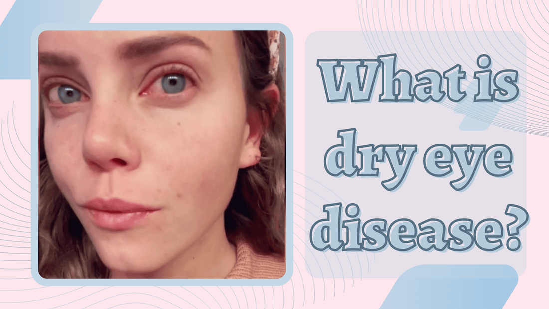 Understanding Dry Eye Disease: Symptoms, Causes, and Treatment Options