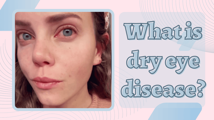 Understanding Dry Eye Disease: Symptoms, Causes, and Treatment Options