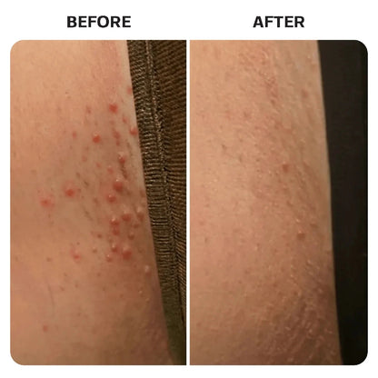 Bikini Line Recovery Kit Base Laboratories 