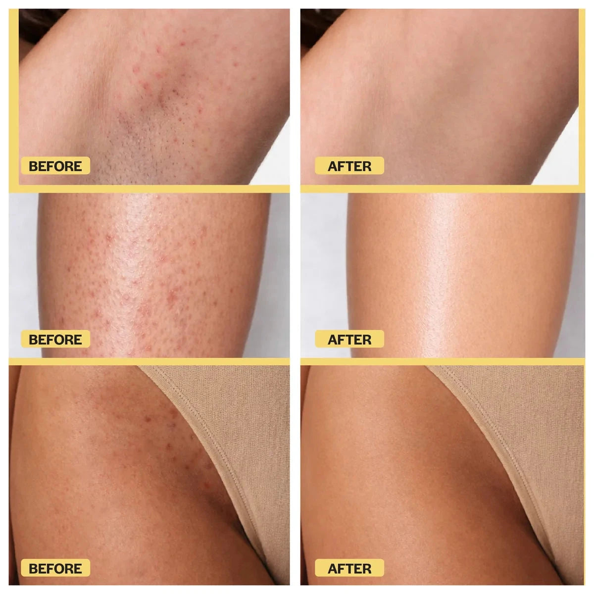 Bikini Line Recovery Kit Base Laboratories 