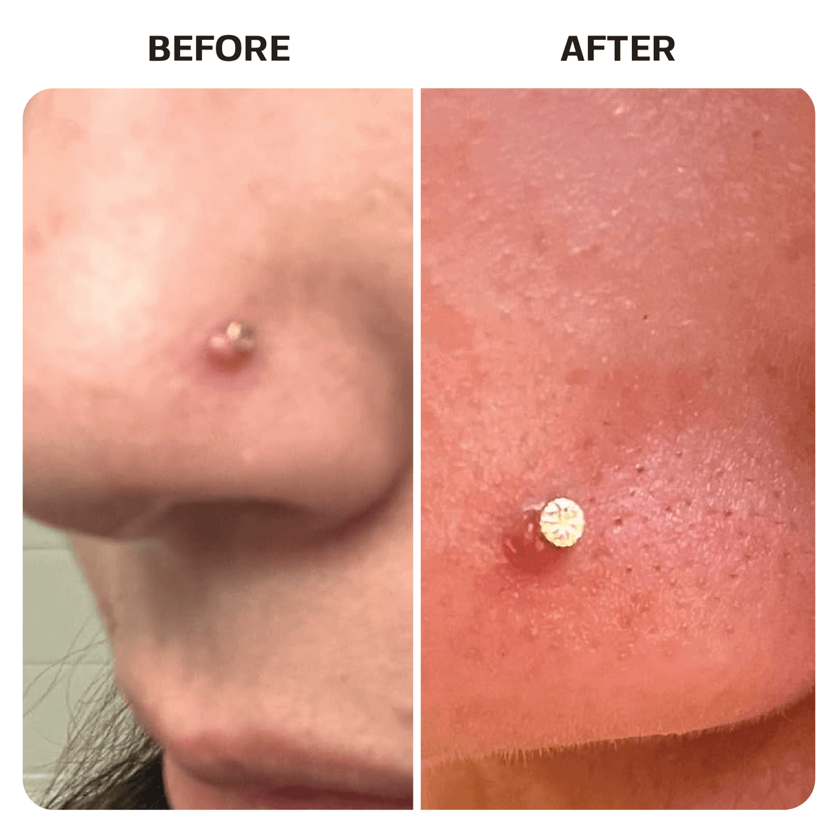 Fresh Piercing Aftercare Kit Bundle Base Laboratories