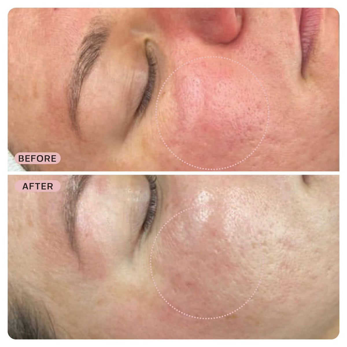HOCL Skin Recovery Duo Bundle Base Laboratories 