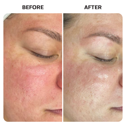 Hypochlorous Acid Spray Topical Base Laboratories 