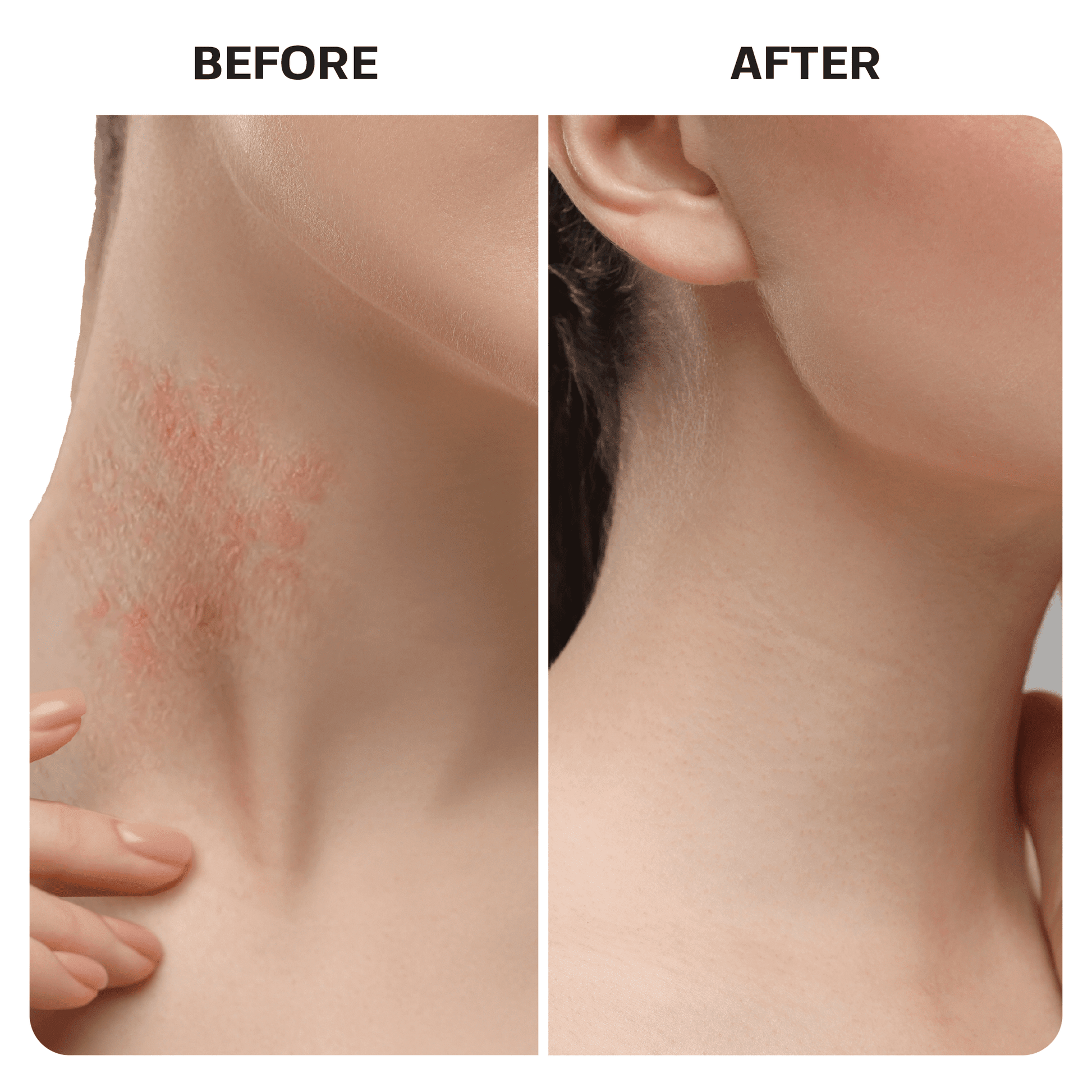 Hypochlorous Acid Spray Topical Base Laboratories 