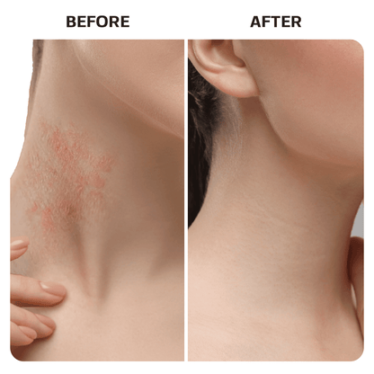 Hypochlorous Acid Spray Topical Base Laboratories 