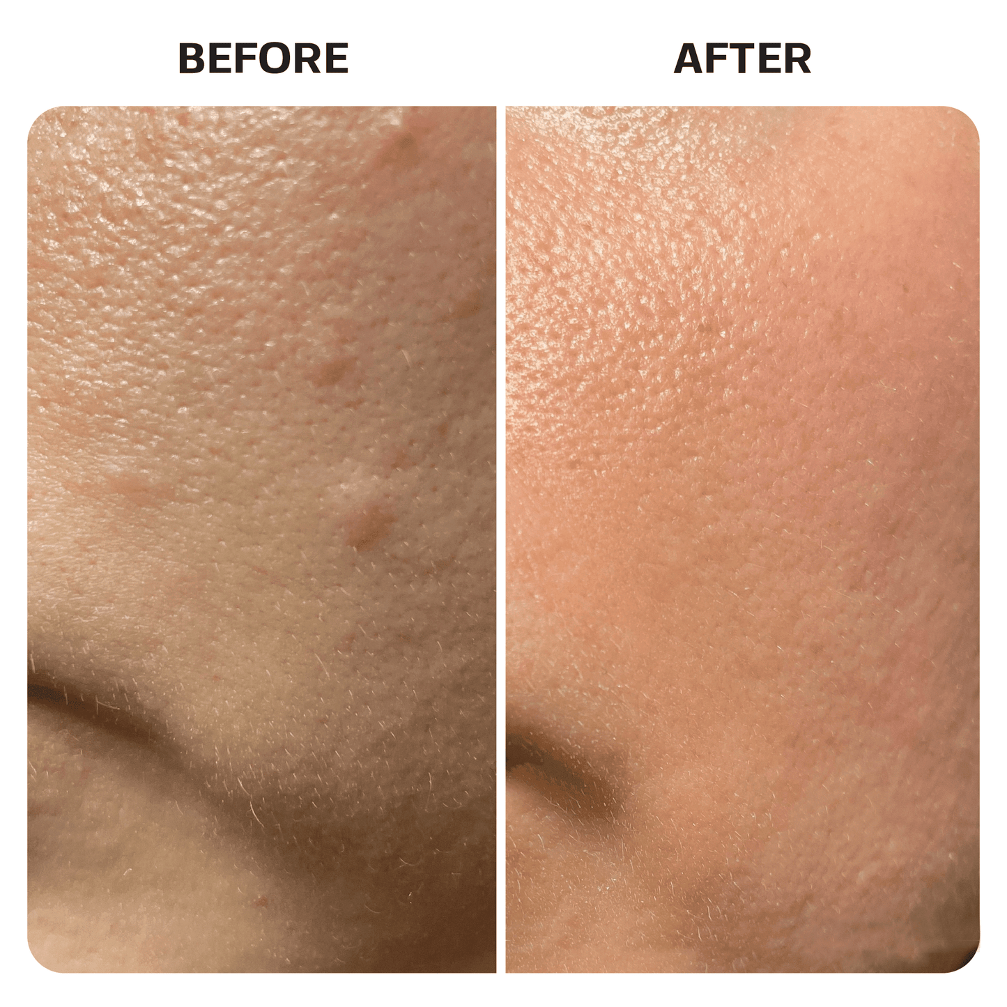 Hypochlorous Acid Spray Topical Base Laboratories 
