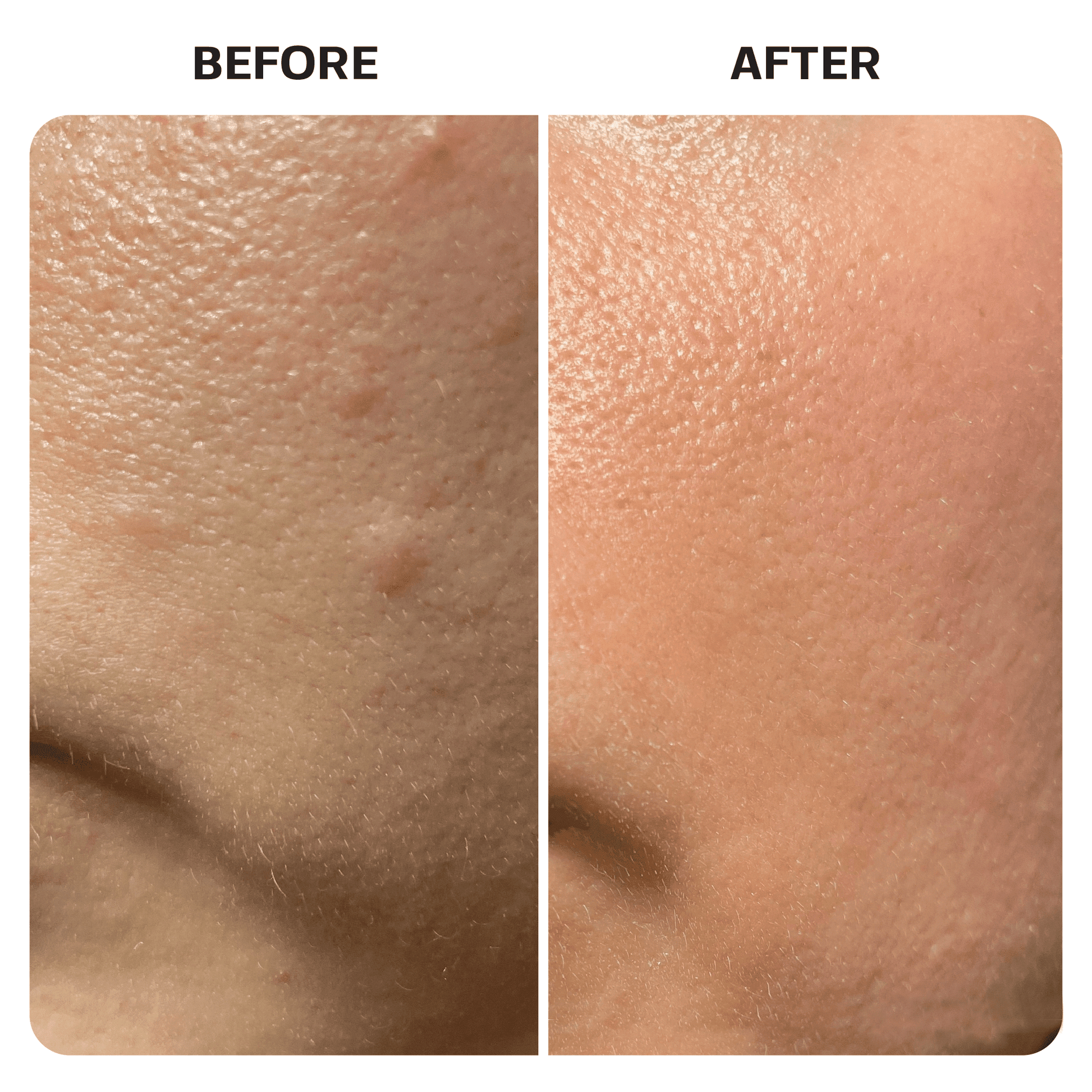Hypochlorous Acid Spray Topical Base Laboratories 