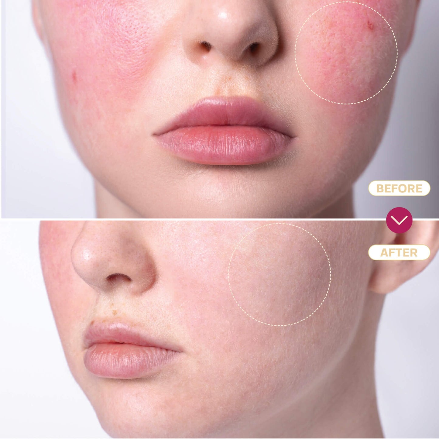 Hypochlorous Acid Spray Topical Base Laboratories 