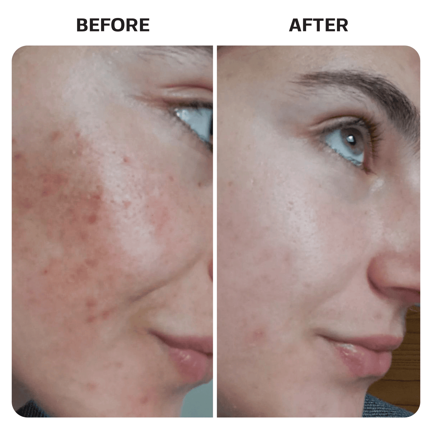 Hypochlorous Acid Spray Topical Base Laboratories 