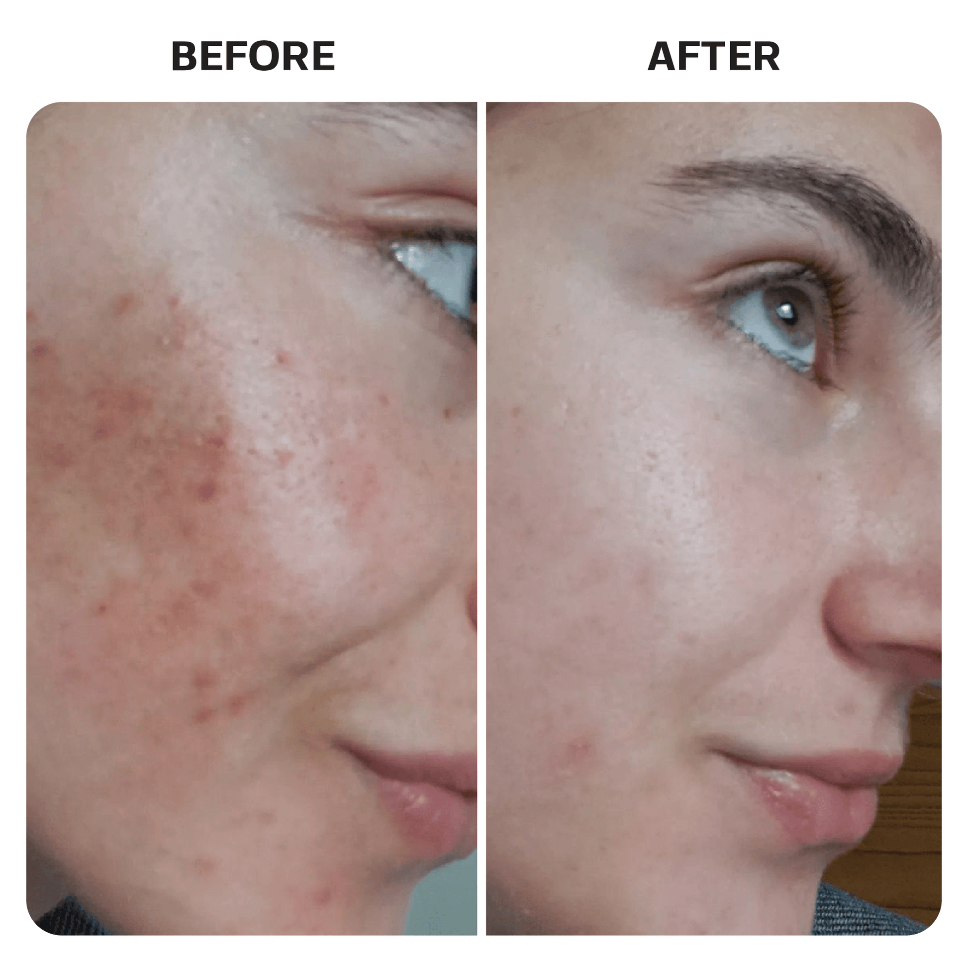 Hypochlorous Acid Spray Topical Base Laboratories 
