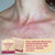 Hypochlorous Acid Wipes for Skin & Face - 75 Ct Topical Base Laboratories 