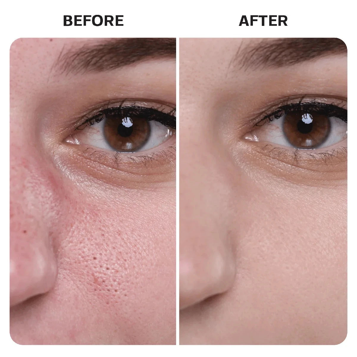 Hypochlorous Acid Wipes Topical Base Laboratories 