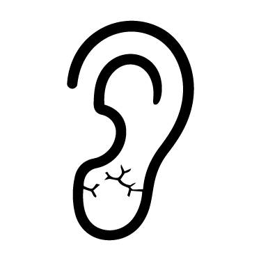 Dry earlobes