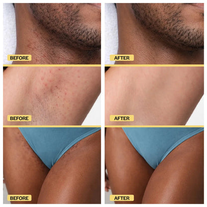 Ingrown Hair Reset Duo Base Laboratories 