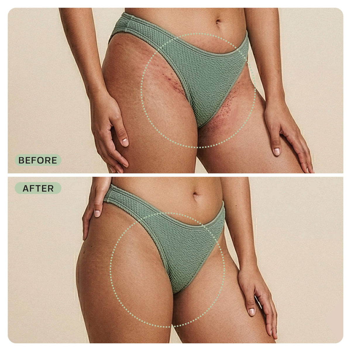Ingrown Hair Reset Duo Bundle Base Laboratories 