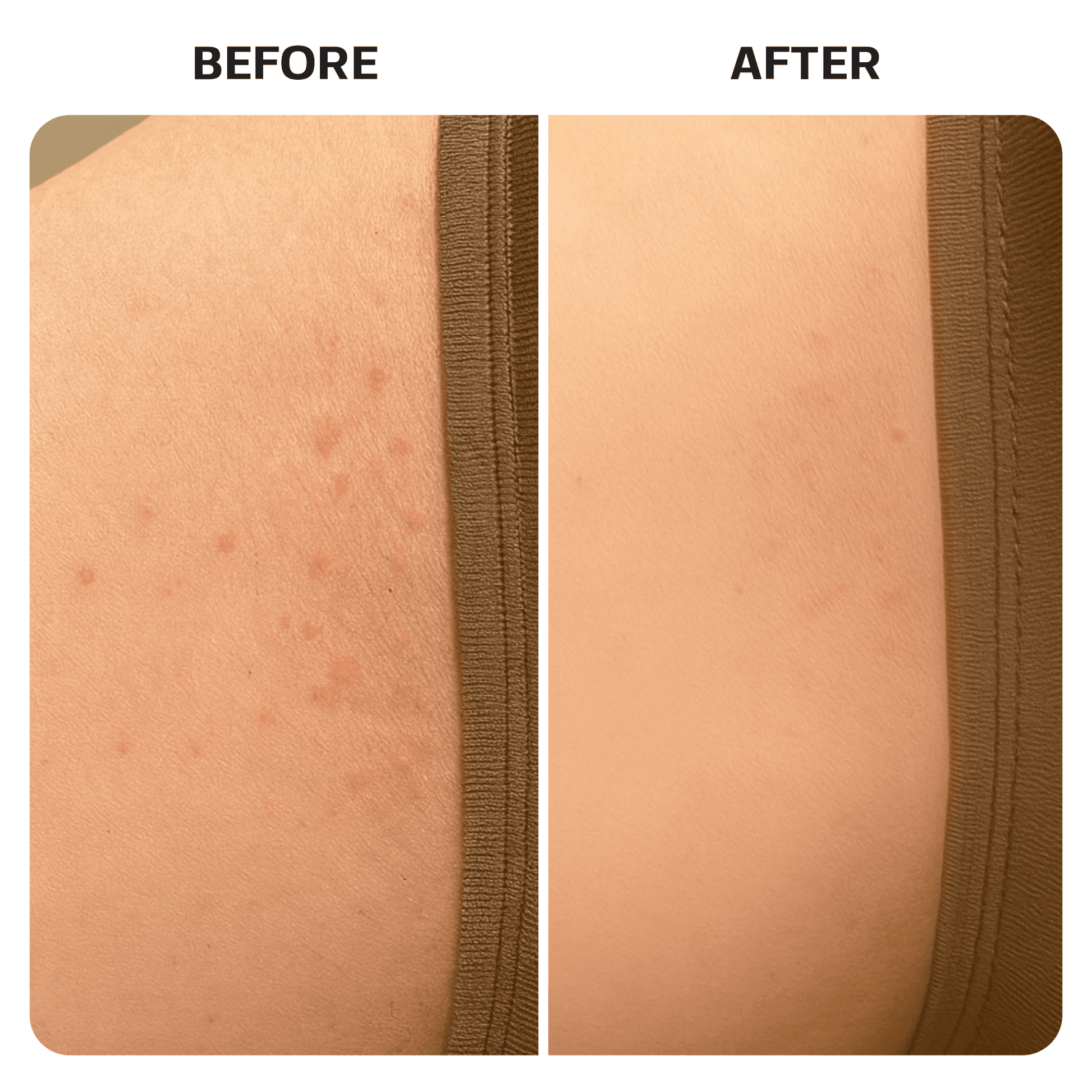 Ingrown Hair Roller Serum ingrown Base Laboratories 