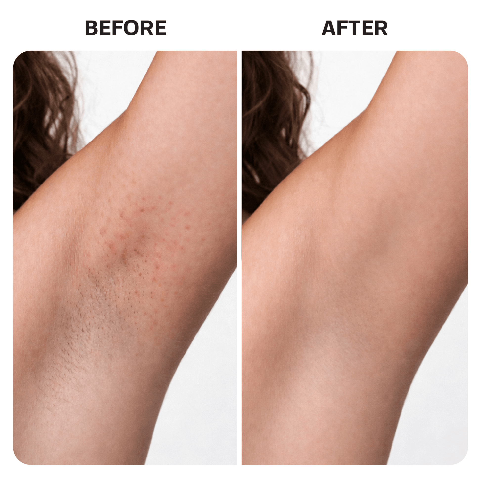 Ingrown Hair Treatment Oil ingrown Base Laboratories 