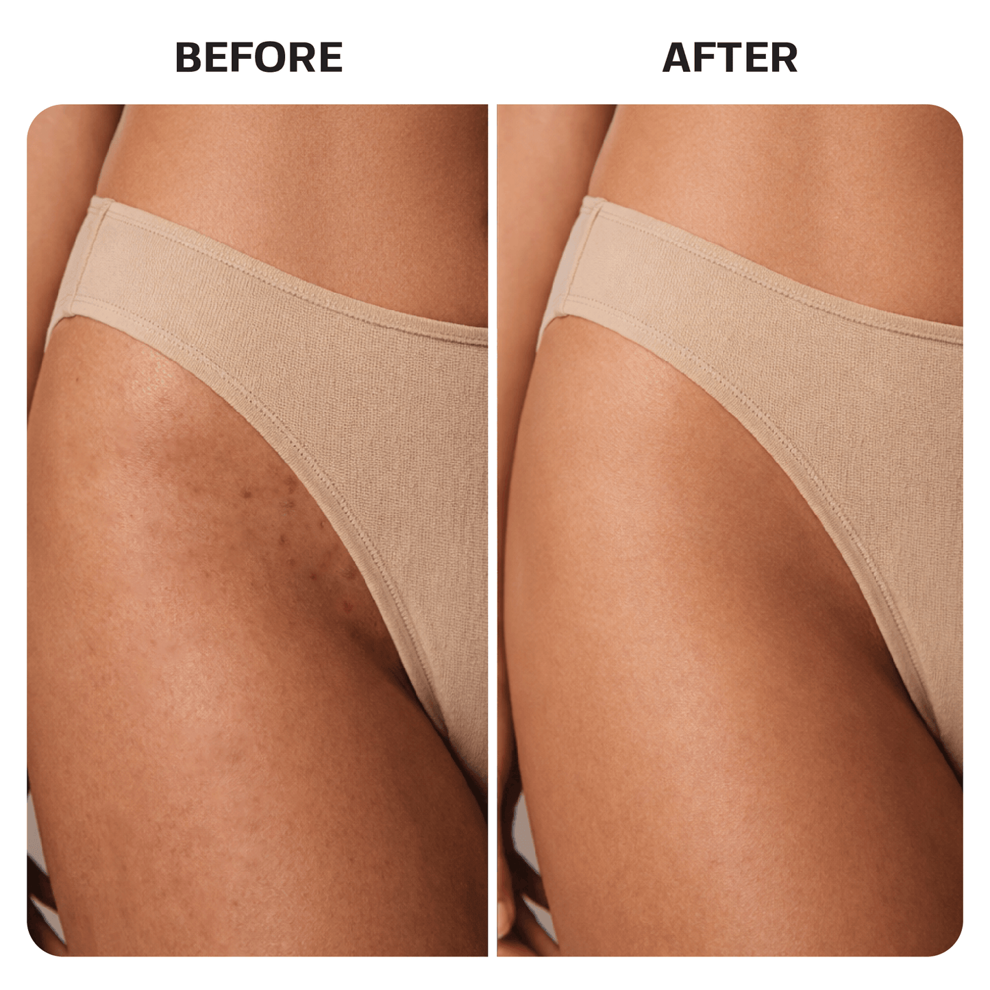 Ingrown Hair Treatment Pads ingrown Base Laboratories 