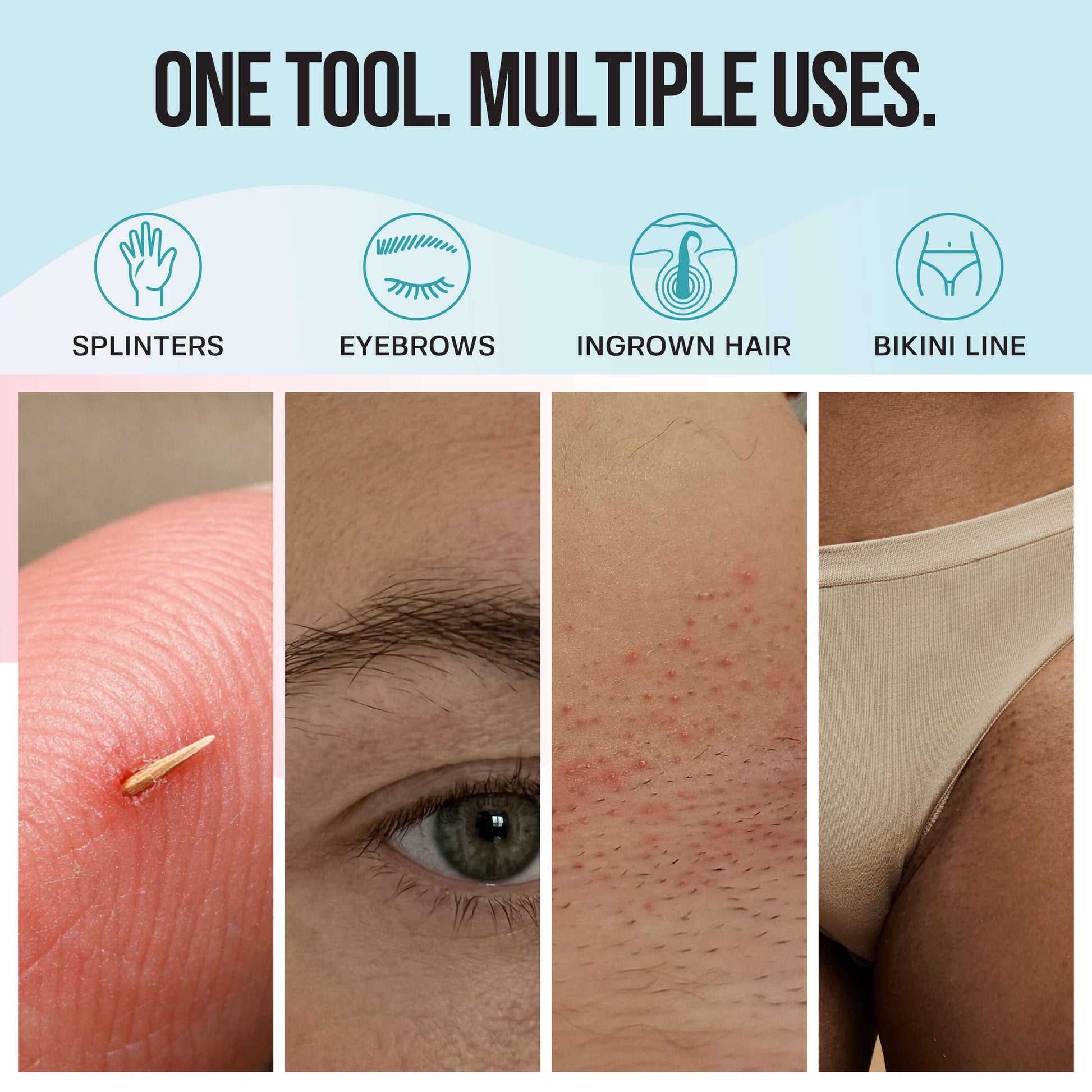 Ingrown Hair Tweezers Set Base Laboratories 