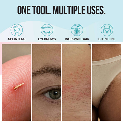 Ingrown Hair Tweezers Set Base Laboratories 