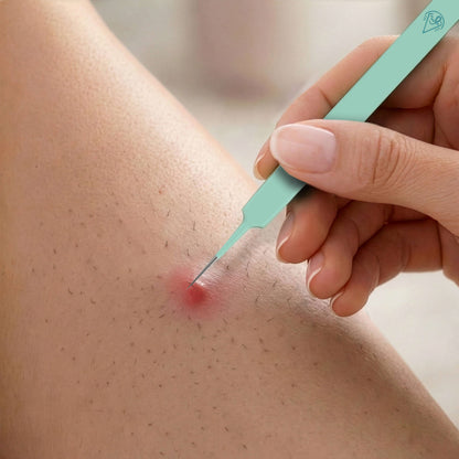 Ingrown Hair Tweezers Set Base Laboratories 
