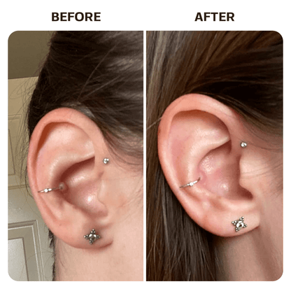 Keloid Bump Removal Gel Swabs Topical Base Laboratories 