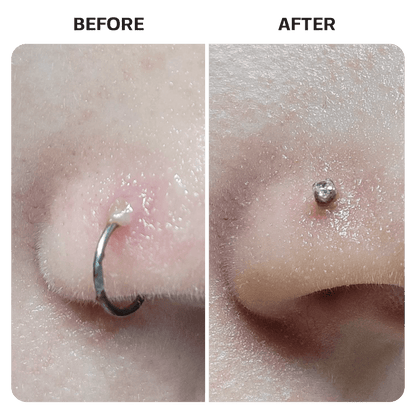 Keloid Bump Removal Gel Swabs Topical Base Laboratories 