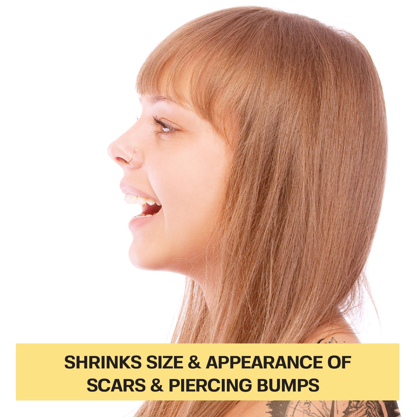 Got a keloid that won't go away? This duo targets it from both angles.