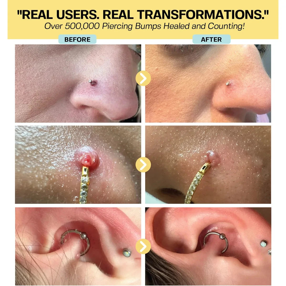 Keloid Repair Duo Bundle Base Laboratories 