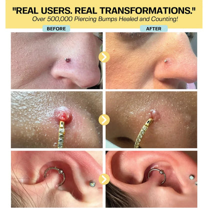 Keloid Repair Duo Bundle Base Laboratories 