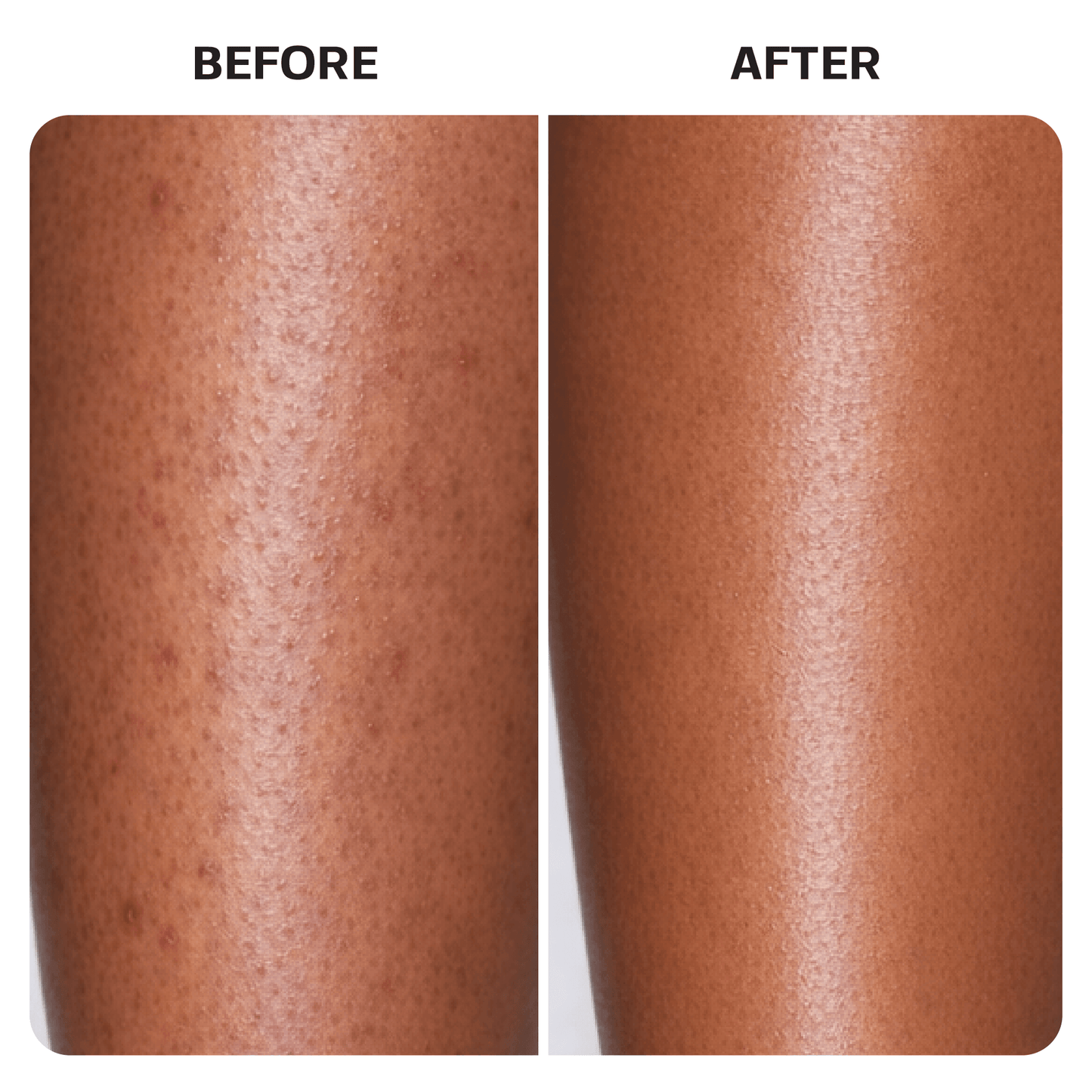 KP Bump Eraser Body Scrub Base Laboratories 