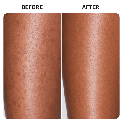 KP Bump Eraser Body Scrub Base Laboratories 