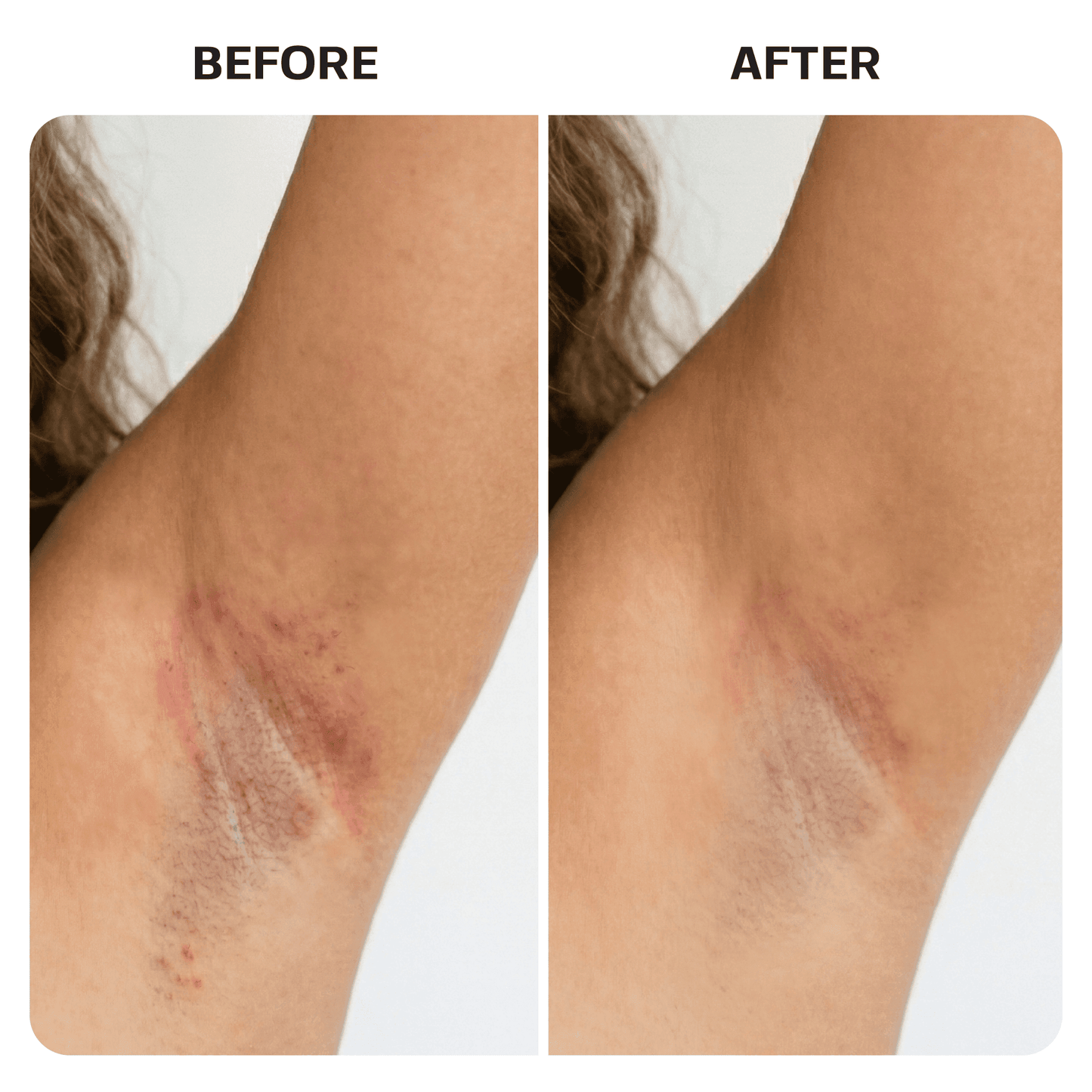 KP Bump Eraser Body Scrub Base Laboratories 