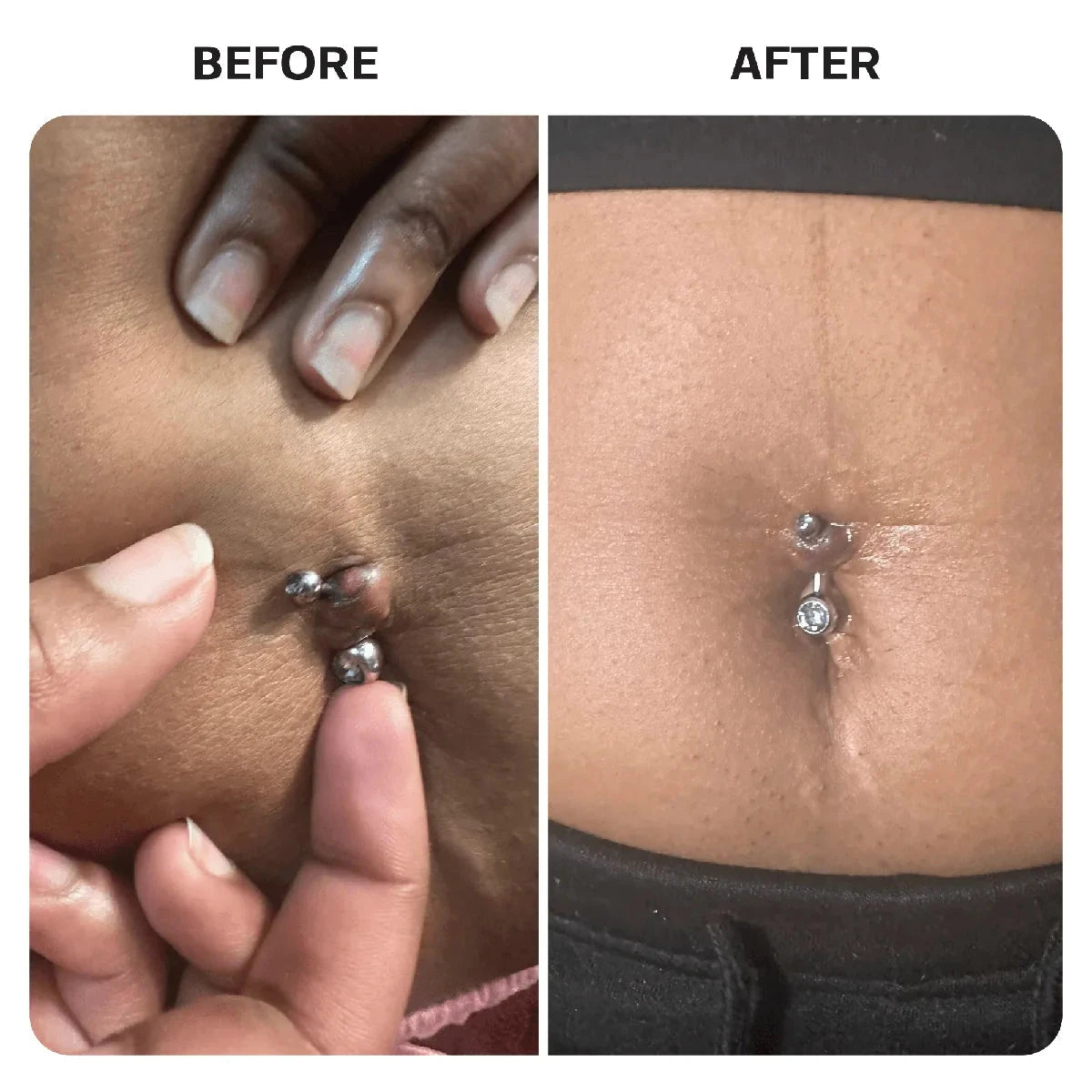 Piercing Aftercare Hypochlorous Acid Spray Topical Base Laboratories 