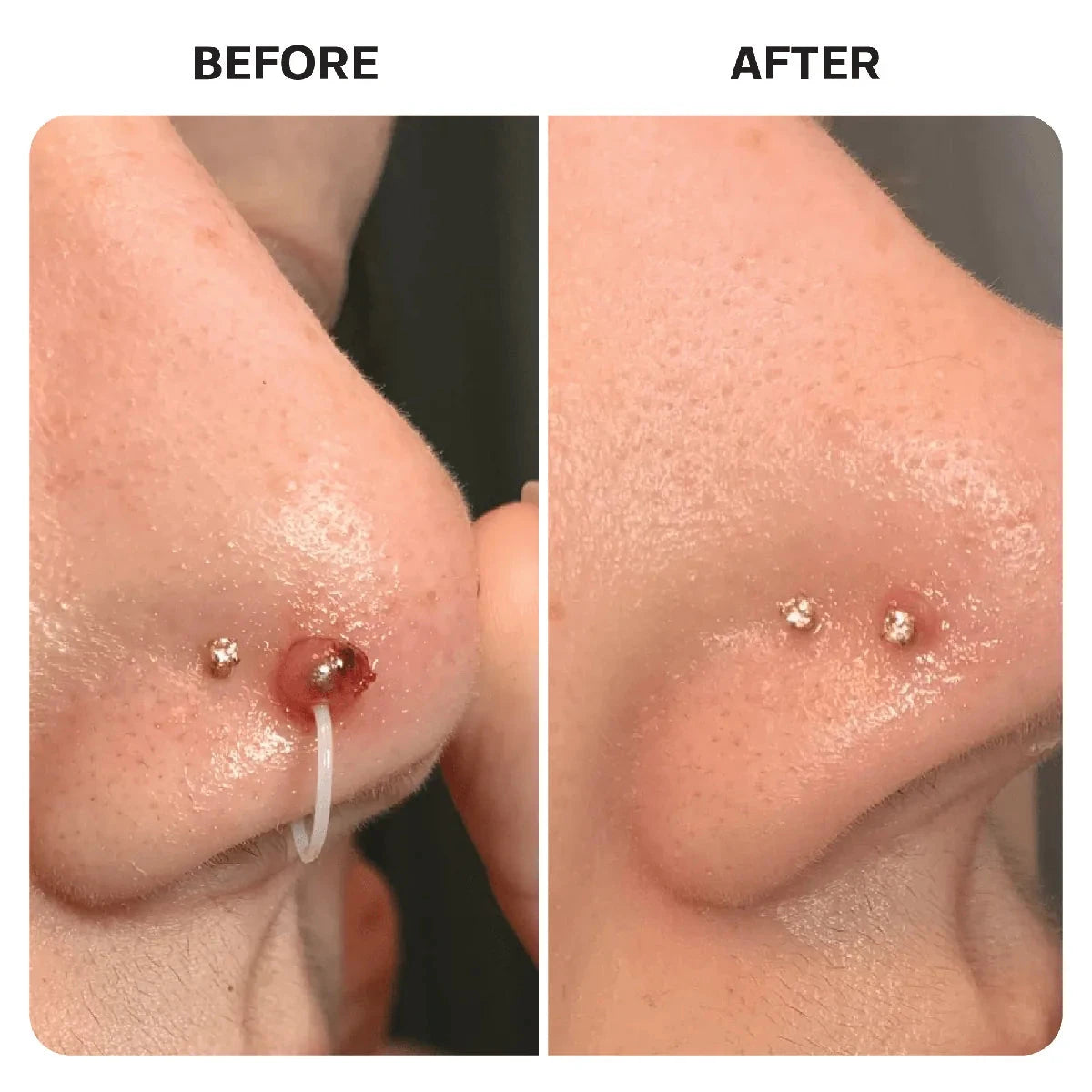 Piercing Aftercare Hypochlorous Acid Spray Topical Base Laboratories 