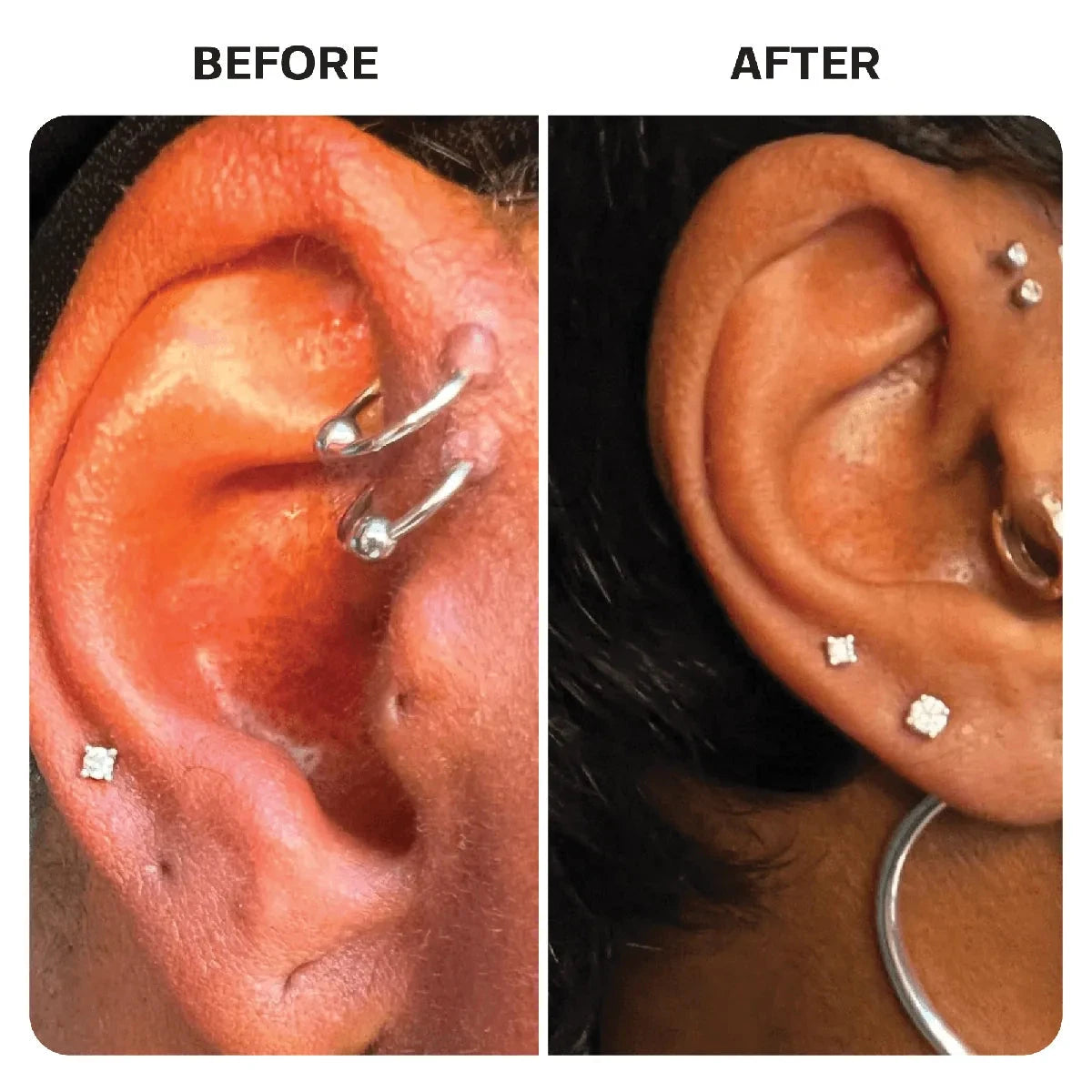 Piercing Aftercare Hypochlorous Acid Spray Topical Base Laboratories 