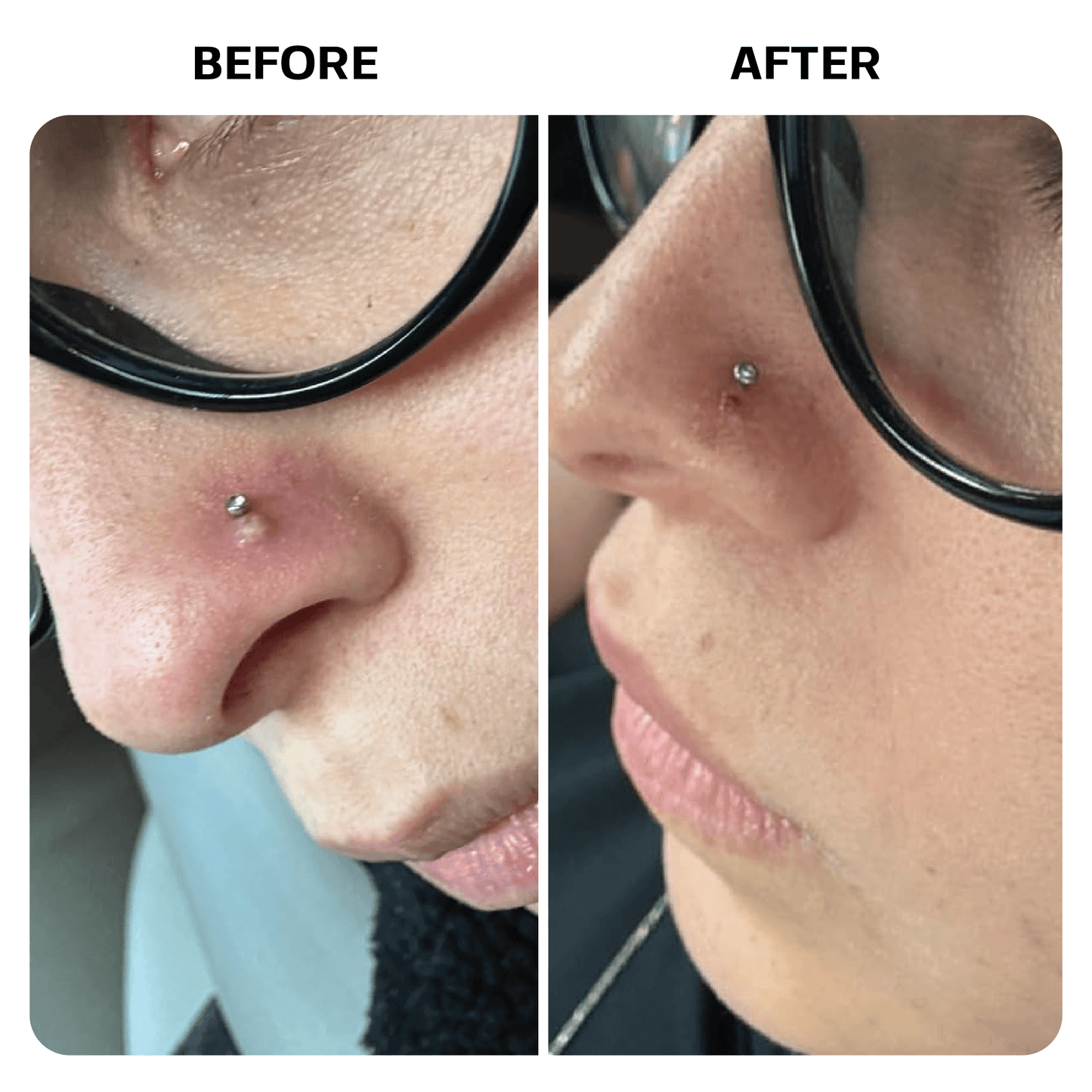 Piercing Aftercare Spray Topical Base Laboratories 