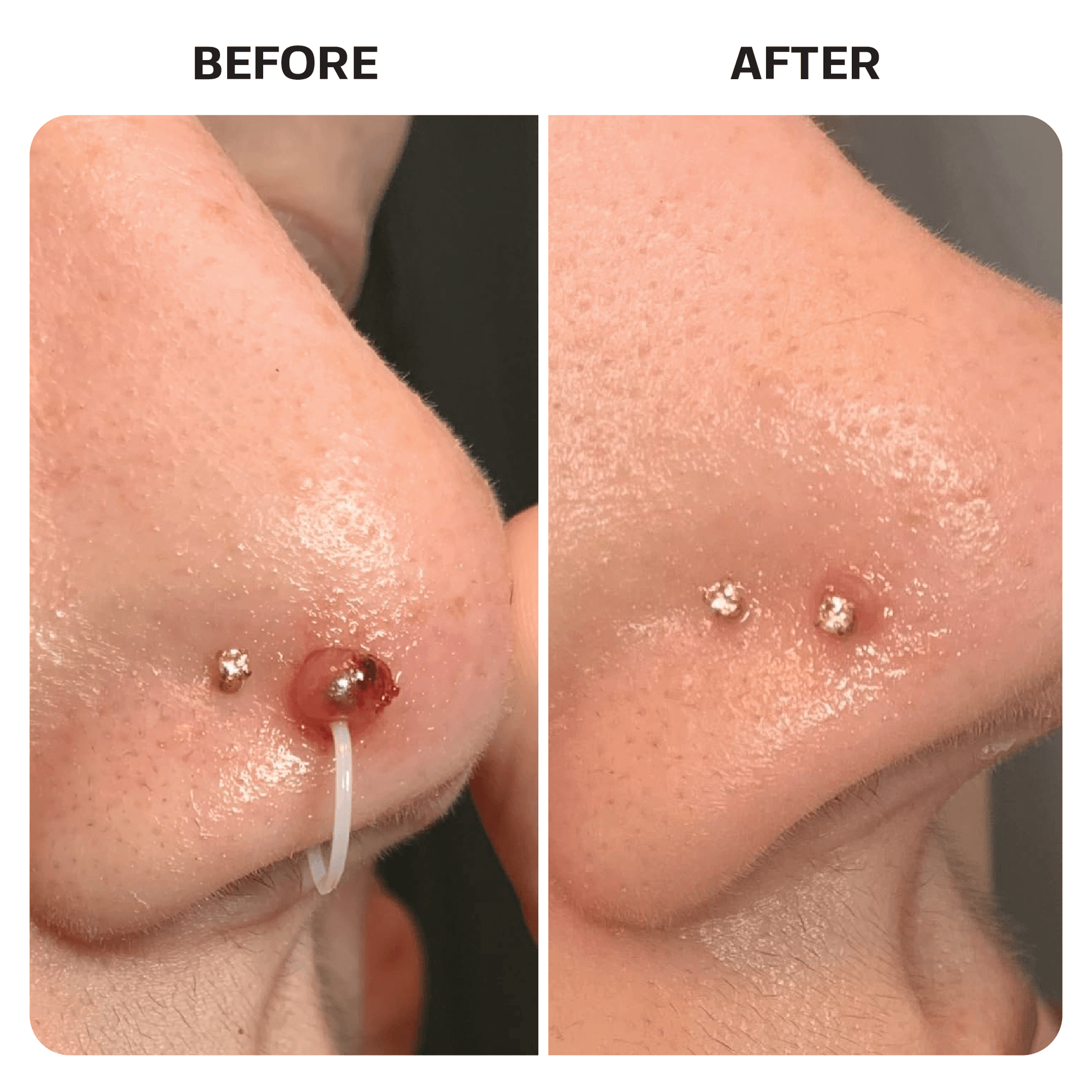 Piercing Aftercare Spray Topical Base Laboratories 