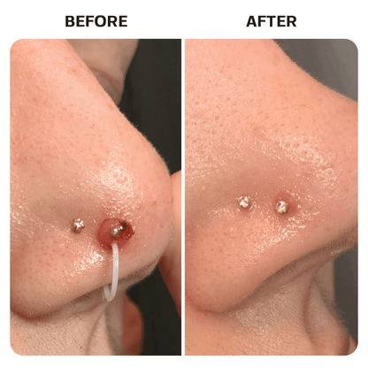 Piercing Aftercare Spray Topical Base Laboratories 