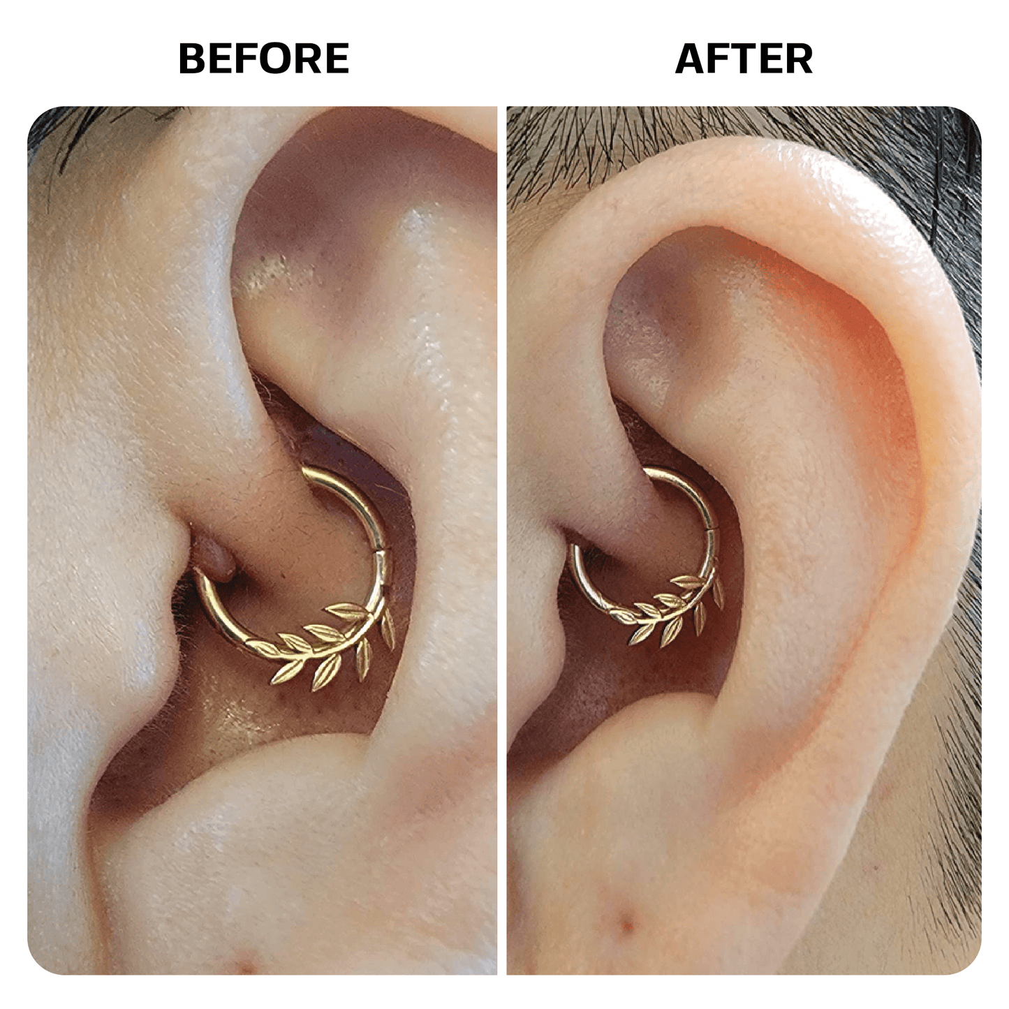 Piercing Aftercare Spray Topical Base Laboratories 