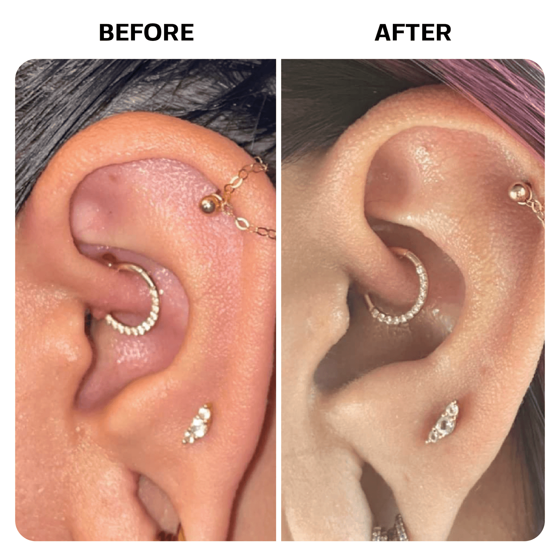 Piercing Bump Oil Topical Base Laboratories 