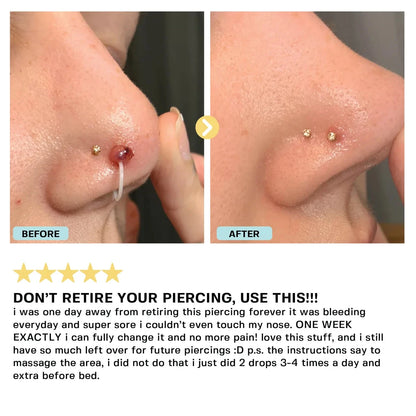 Piercing Bump Oil Topical Base Laboratories 