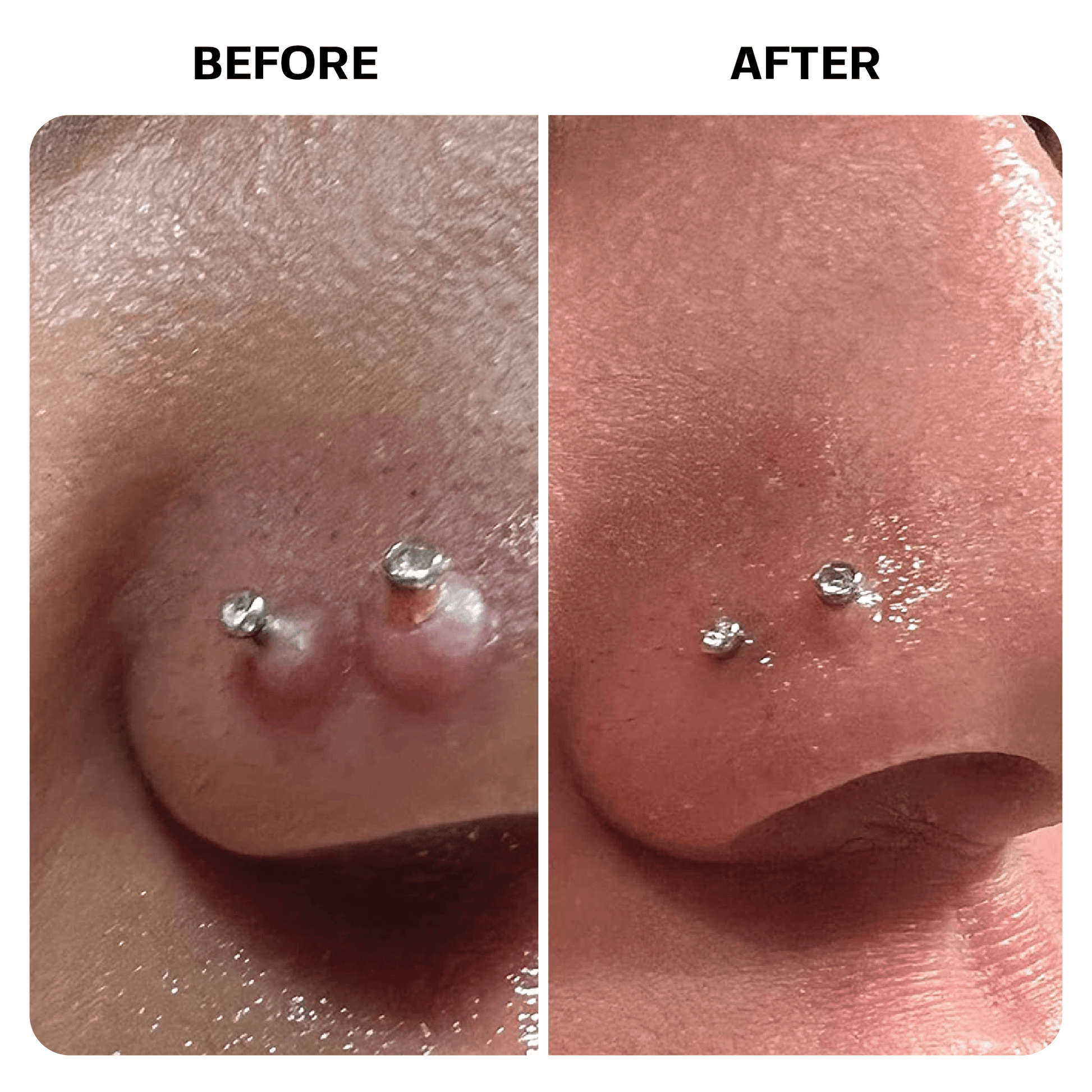 Piercing Bump Oil Topical Base Laboratories 