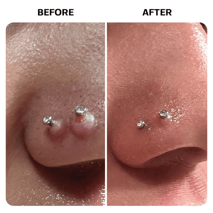 Piercing Bump Oil Topical Base Laboratories 