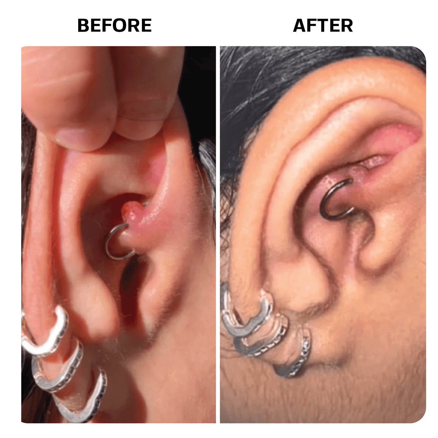 Piercing Bump Oil Topical Base Laboratories 