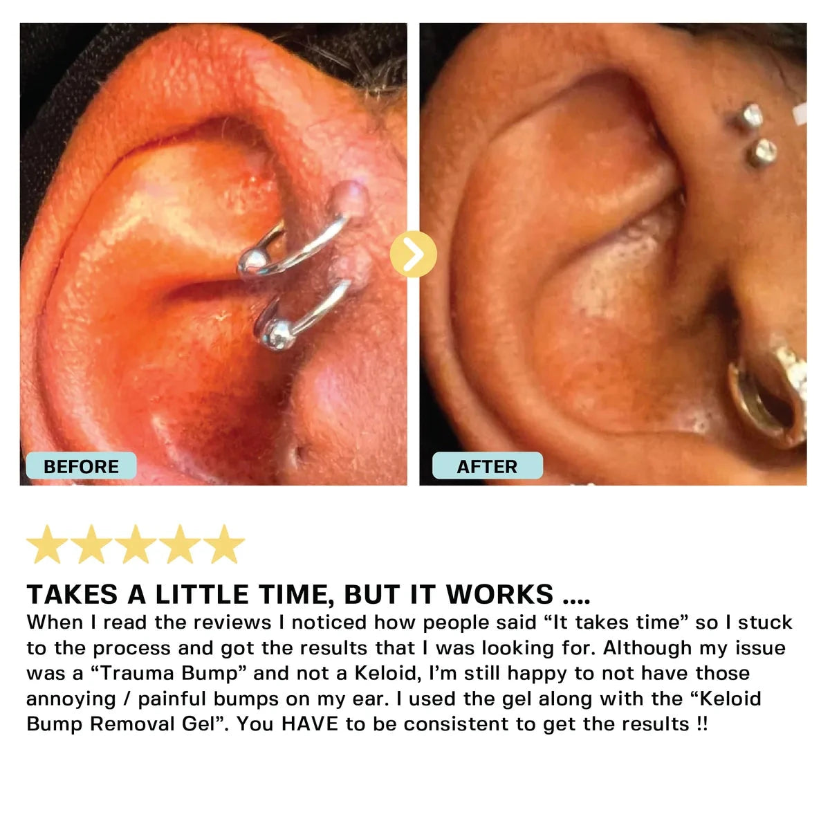 Piercing Bump Oil Topical Base Laboratories 