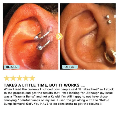 Piercing Bump Oil Topical Base Laboratories 