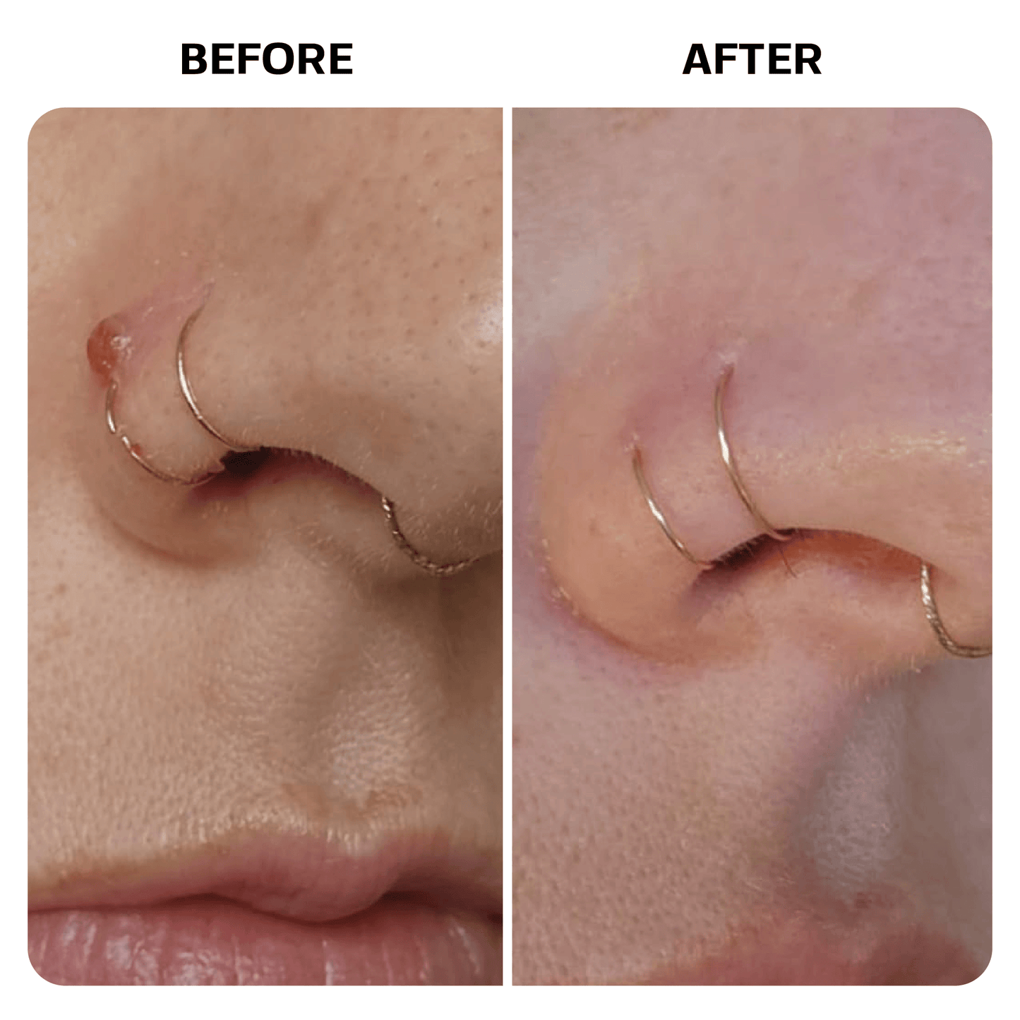 Piercing Bump Oil Topical Base Laboratories 