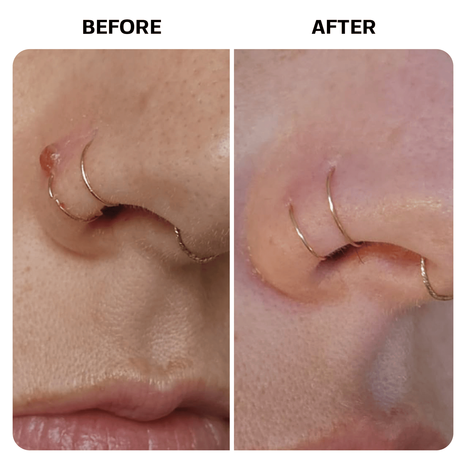 Piercing Bump Oil Topical Base Laboratories 